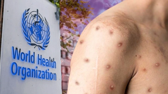 İki Yıl İçinde İkinci Kez! DSÖ'den Küresel Çağrı